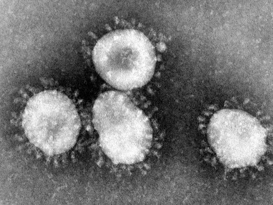 Neues Coronavirus breitet sich weiter aus: Erster Fall in Singapur